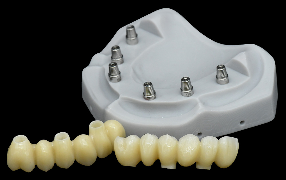 base基台+上部半口氧化锆修复冠（分体）