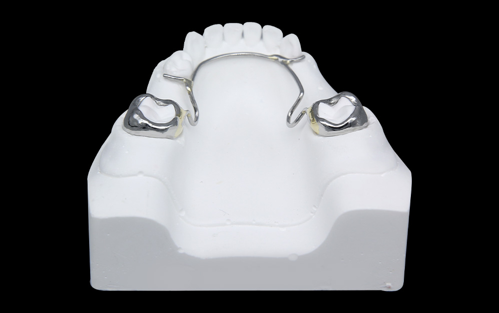 舌弓缺失维持器