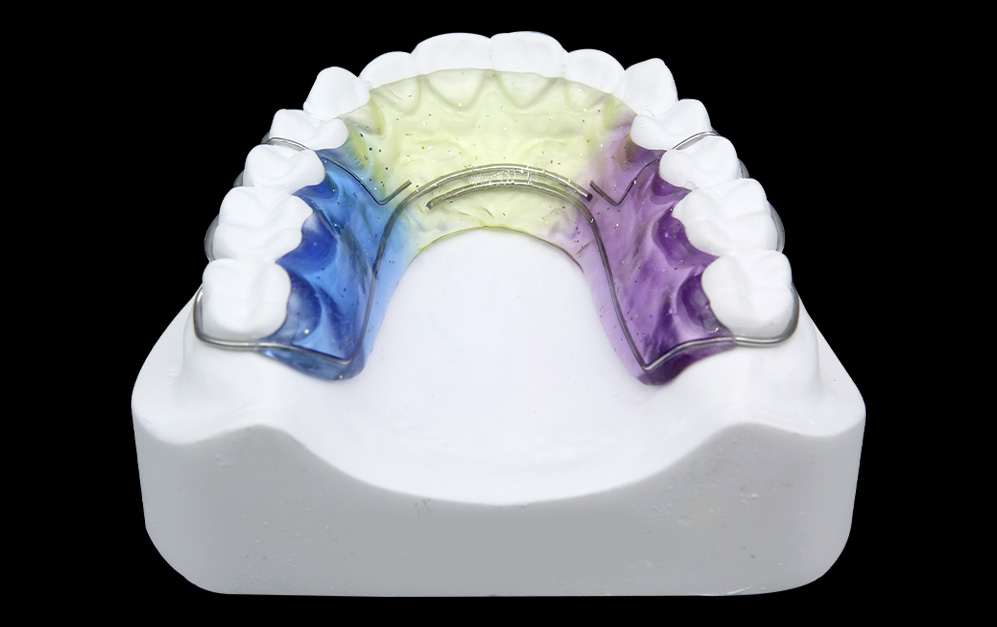包围比格保持器（Hawley）