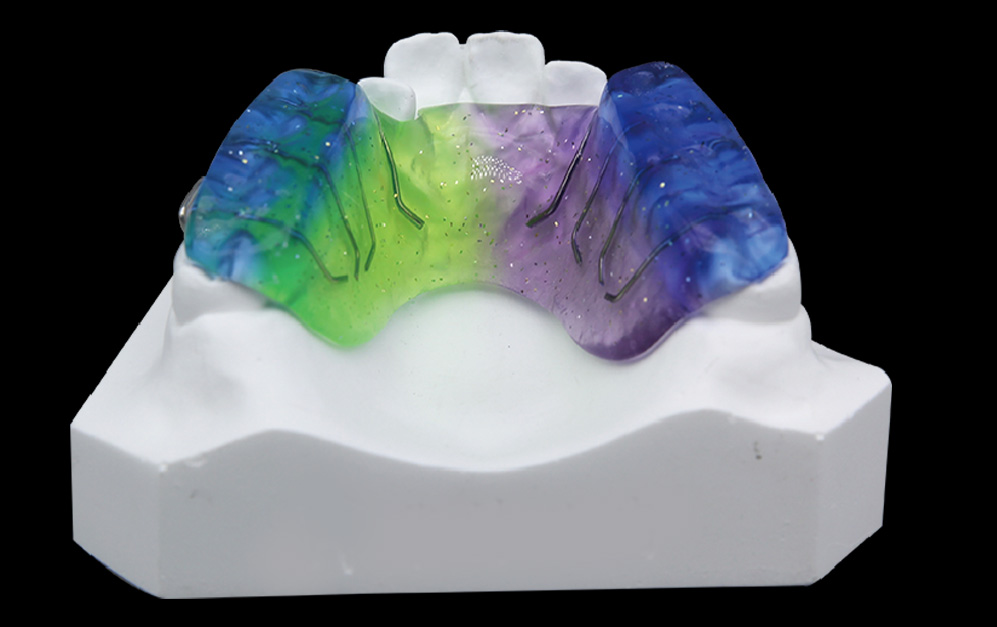 前方牵引矫治器