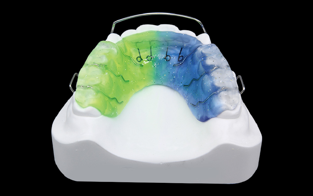 导弓式颌垫矫治器