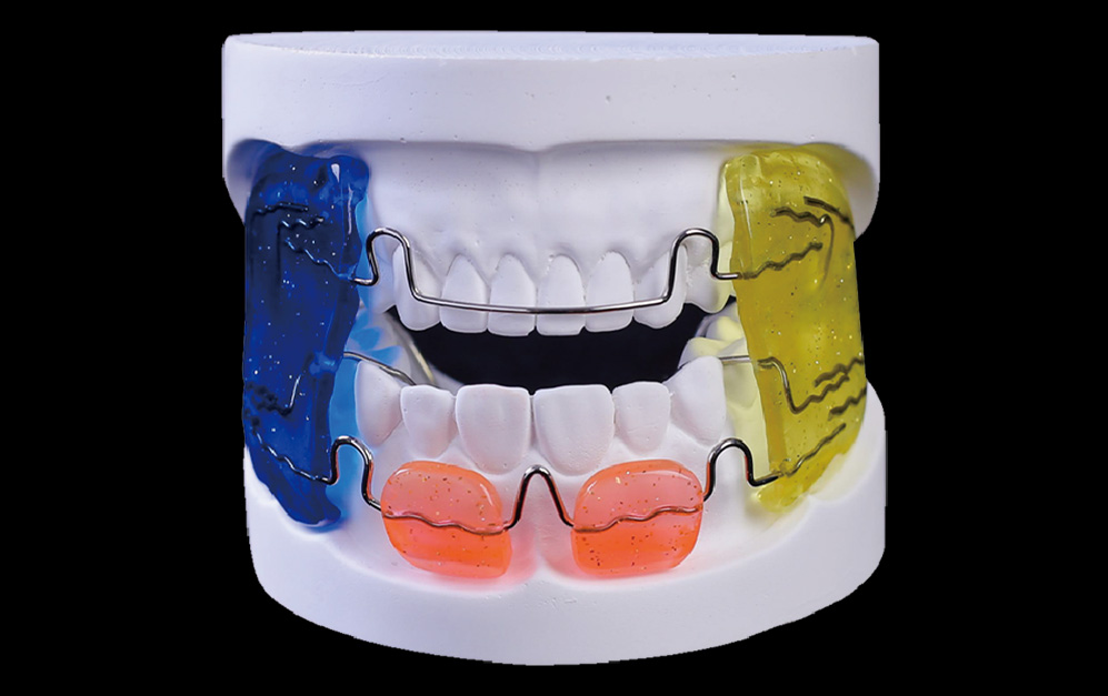 法兰克Ⅲ功能矫治器（FR3）