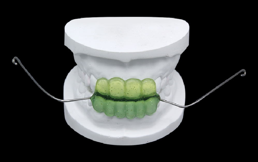 头帽式/改良式肌激动器（Van Beek）