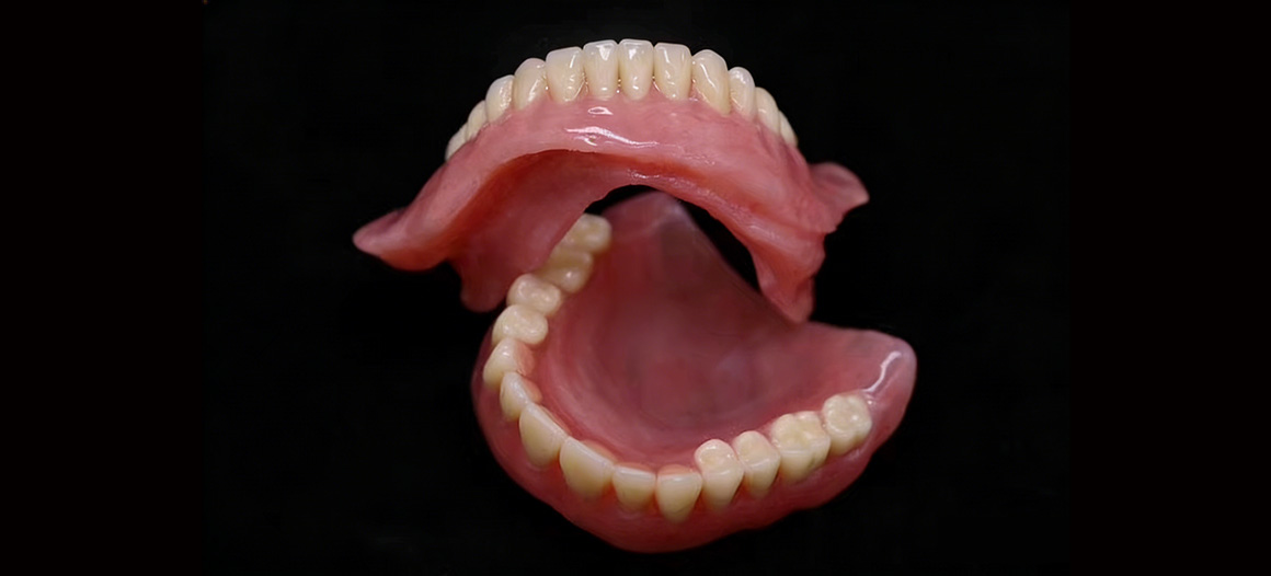 华创吸附性义齿